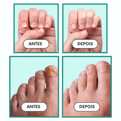 +1 Unidade com 50% de Desconto