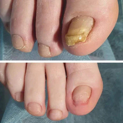 +1 Unidade com 50% de Desconto